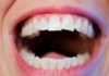 Prendre soin de ses dents : les gestes à adopter !